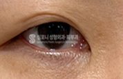 흐릿한 라인 — 눈 사진